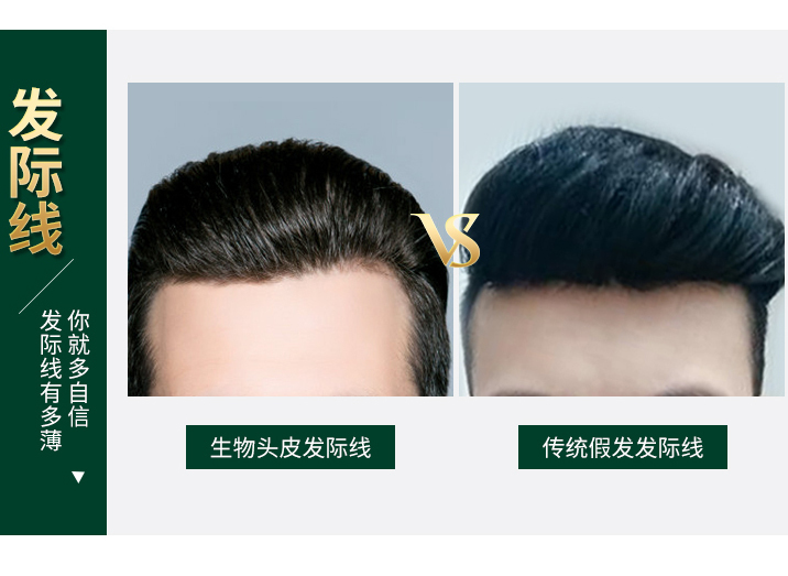 补发靠谱吗_无痕补发怎么样_补发能坚持多久 补发靠谱吗_无痕补发怎么样_补发能坚持多久