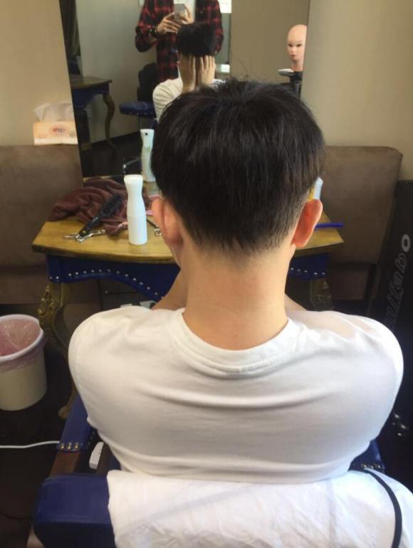织发补发效果对比图2 织发补发效果对比图2