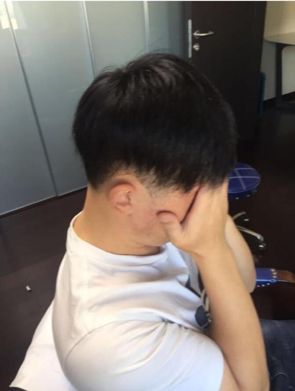 织发补发效果对比图3 织发补发效果对比图3