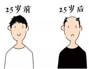 分析ZUI容易脱发的三种职业