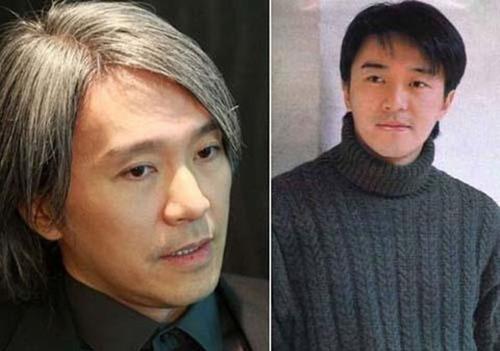 织发补发效果对比图 织发补发效果对比图
