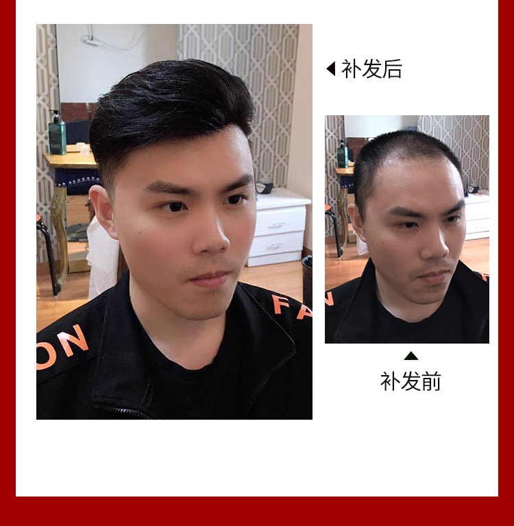 补发前后效果对比图 补发前后效果对比图