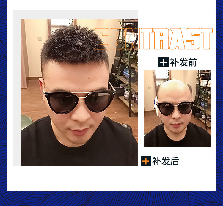 补发前后效果对比图 补发前后效果对比图