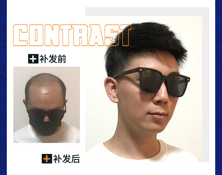 补发前后效果对比图 补发前后效果对比图