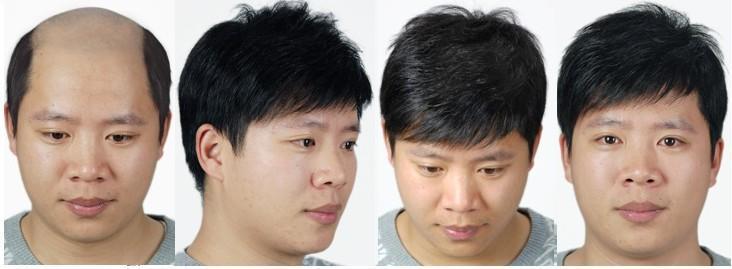 对比照 对比照