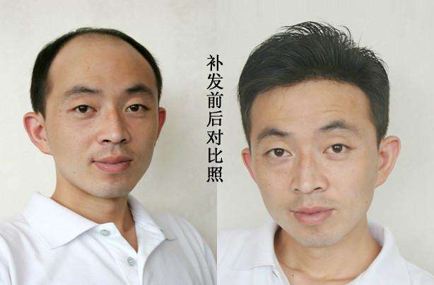 补发机构的效果怎么样？