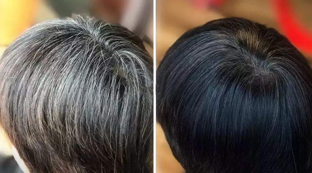 中老年局部假发哪里可以定制？