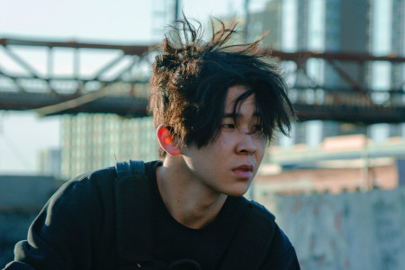 什么原因容易导致脱发？你在脱发吗？