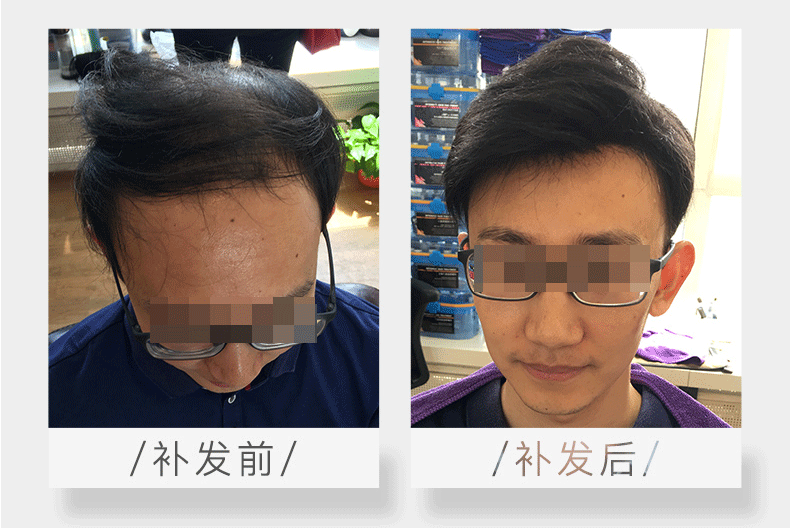假发怎么戴？步骤详细到一看就会！