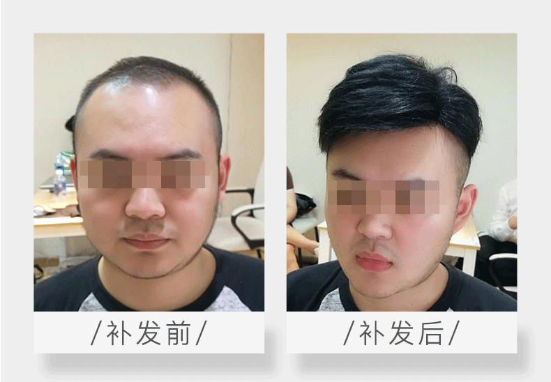 补发效果