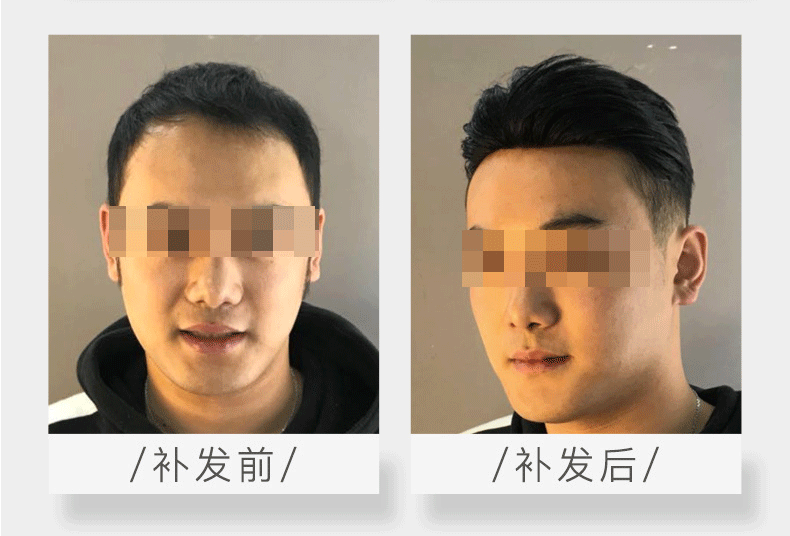 怎么才能快速增发密发？