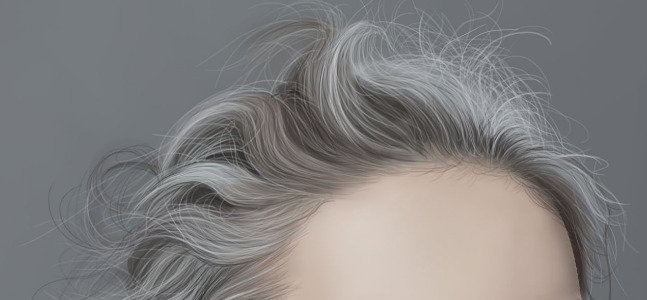 发际线后移怎么办？这3点ZUI有效