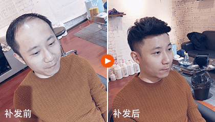 补发效果 补发效果