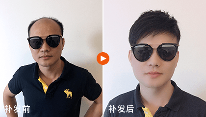 补发效果 补发效果