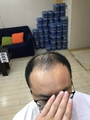 补发前效果 补发前效果