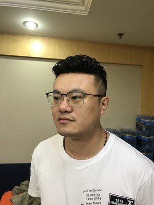 补发后正面效果 补发后正面效果