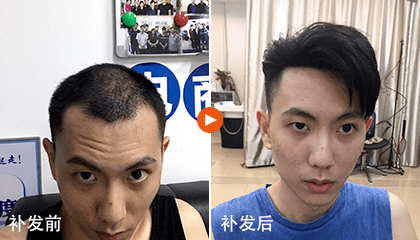 补发效果对比图