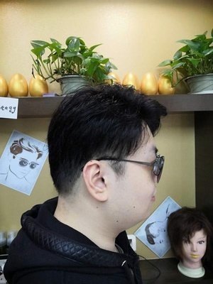假发补发后侧面效果 假发补发后侧面效果