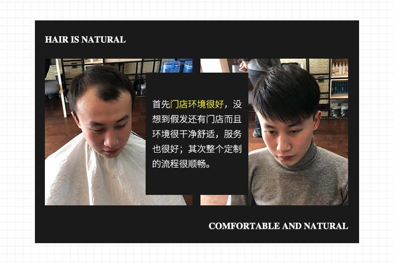 真发假发补发效果图 真发假发补发效果图