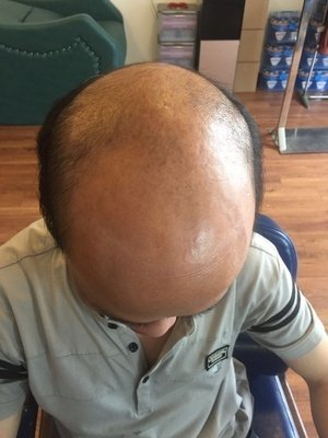补发前效果 补发前效果