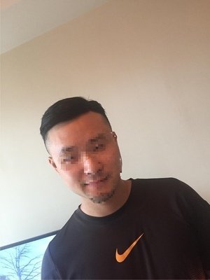 补发后效果