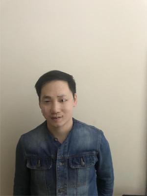补发前效果