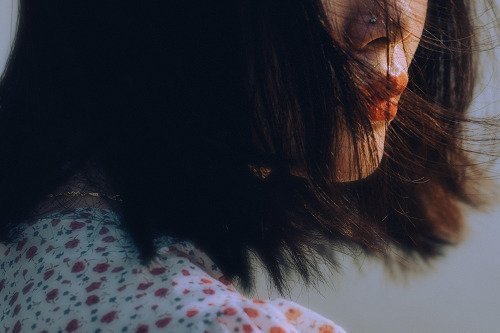 ​青春发育期为何脱发？掌握青少年脱发！