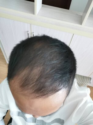 补发前效果 补发前效果