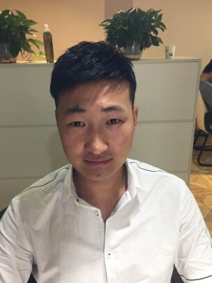补发后效果 补发后效果