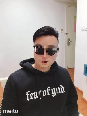 天津发友补发后效果 天津发友补发后效果