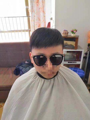 补发后效果 补发后效果