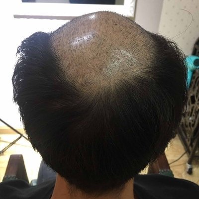 补发前效果图 补发前效果图