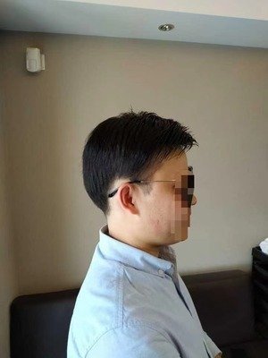 补发后效果图 补发后效果图