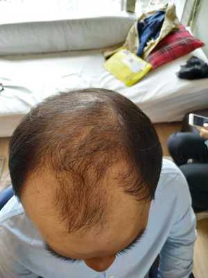 补发前效果图 补发前效果图