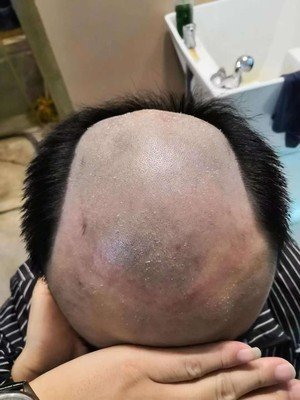 补发前效果图 补发前效果图