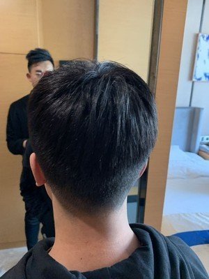 假发补发后效果图 假发补发后效果图