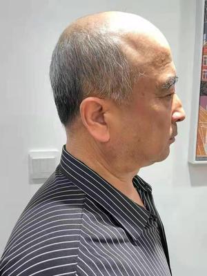 补发前侧面图 补发前侧面图