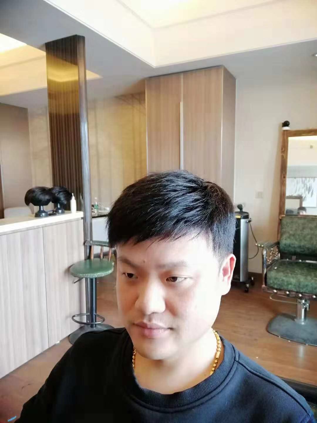 补发后效果 补发后效果
