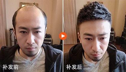 什么地方补发效果好？