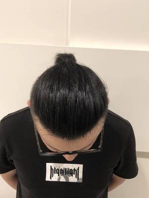 补发后帅气发型 补发后帅气发型