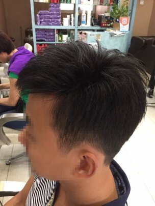 补发后侧面效果 补发后侧面效果