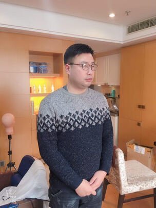 极客假发补发后侧面效果 极客假发补发后侧面效果