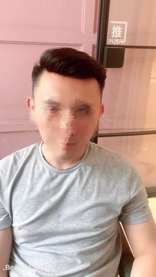大背头补发正面效果 大背头补发正面效果