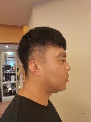补发后年轻效果 补发后年轻效果