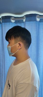补发后正面效果 补发后正面效果
