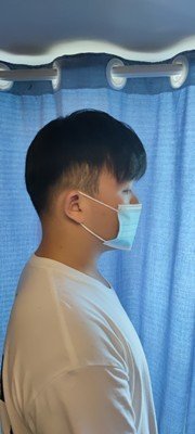 补发后侧面效果 补发后侧面效果