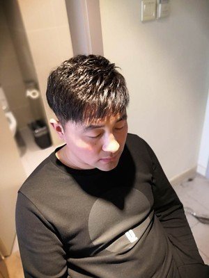 补发后正面效果 补发后正面效果