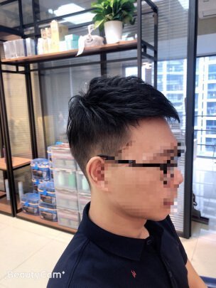 补发后侧面效果