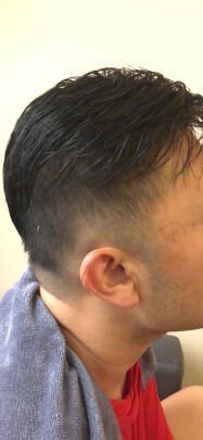 补发后效果 补发后效果