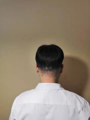 补发后效果 补发后效果